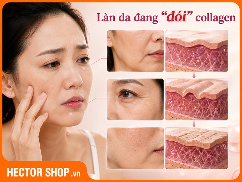 Thiếu collagen là một trong những nguyên nhân chính khiến làn da xuống cấp