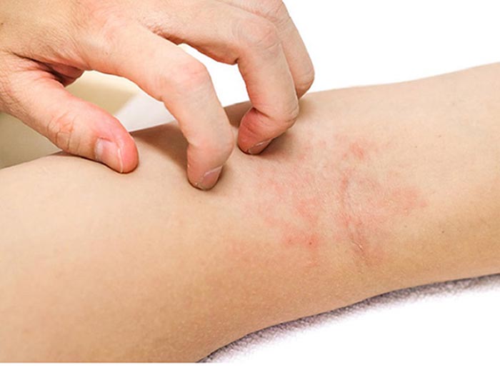 Uống collagen có tác dụng phụ không: 6 phát hiện đáng chú ý