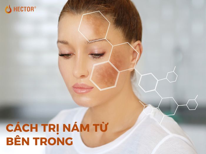 Top 25+ thức uống trị nám từ bên trong an toàn và hiệu quả