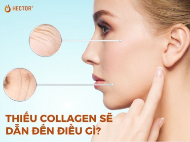 Thiếu collagen sẽ dẫn đến điều gì? Top 8 hệ quả đáng lo ngại