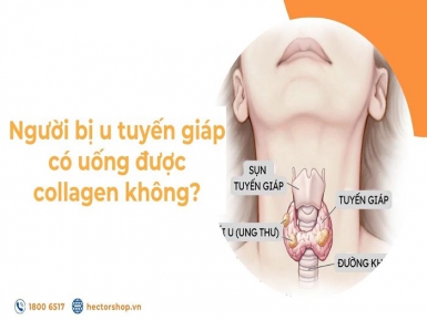 Bị u tuyến giáp uống được collagen không? Đâu là giải pháp?